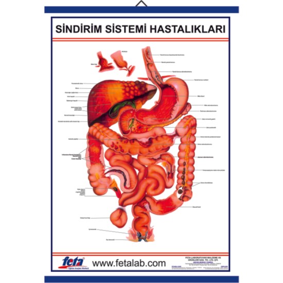 Edulab Sindirim Sistemi Hastal Klar E Itim Plakas Fiyat