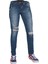 1059 Erkek Denim Lazer Işlemli 1