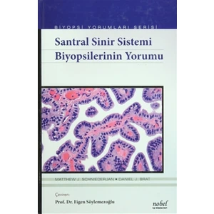 Santral Sinir Sistemi Biyopsilerinin Yorumu