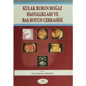 Kulak Burun Boğaz Hastalıkları Baş Boyun Cerrahisi