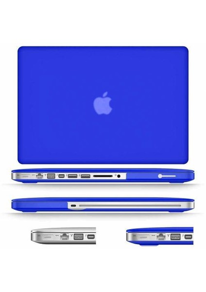 APPLE MACBOOK AİR 11.6 KILIF 2in1 SİLİKON MAT DOKU