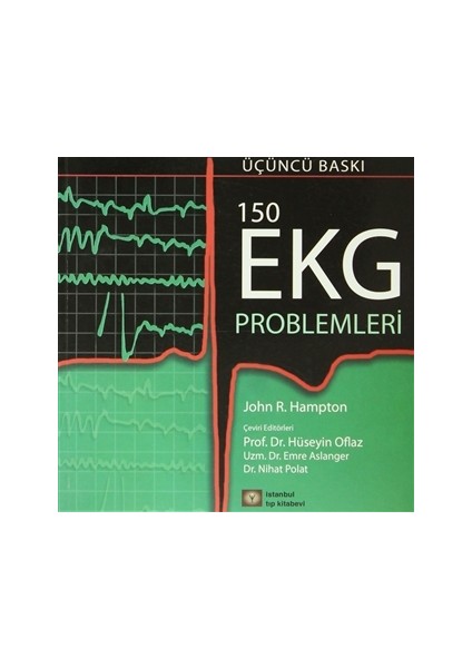 150 EKG Problemleri