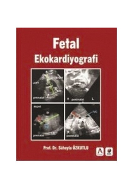 Fetal Ekokardiyografi - Süheyla Özkutlu