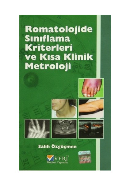 Romatolojide Sınıflama Kriterleri ve Kısa Klinik Metroloji