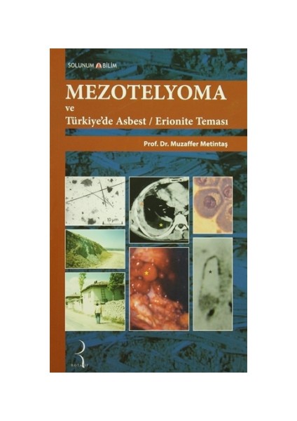 Mezotelyoma ve Türkiye'de Asbest / Erionite Teması