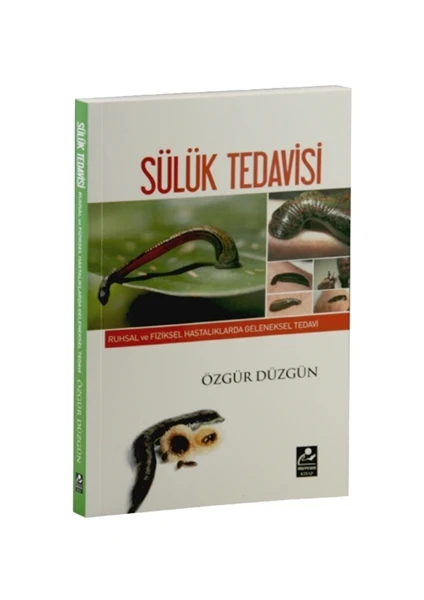 Ruhsal ve Fiziksel Hastalıklarda Geleneksel Tedavi - Sülük Tedavisi - Özgür Düzgün