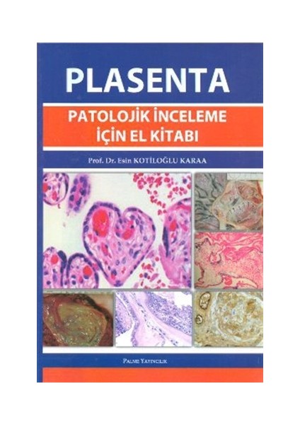 Plasenta Patolojik İnceleme İçin El Kitabı
