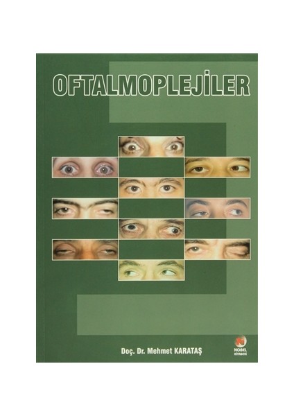 Oftalmoplejiler