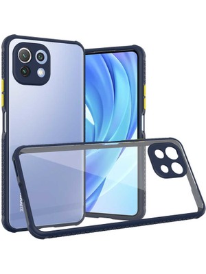 noktaks - Xiaomi Mi 11 Lite - Kılıf ​​Arkası Şeffaf Sert Kaff Kapak - Lacivert - T17852