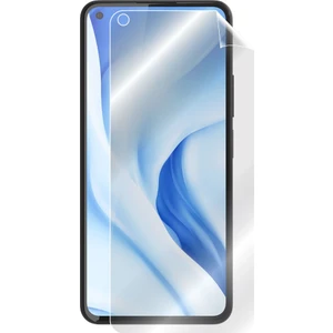 Ipg Xiaomi Mi 11 Lite - 5g Tam Kaplama