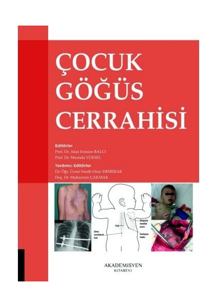 Çocuk Göğüs Cerrahisi