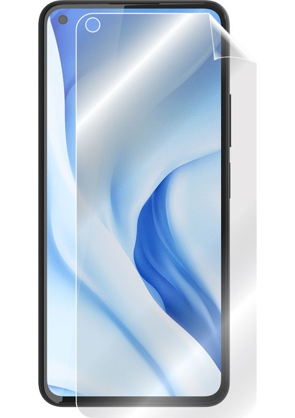 Xiaomi Mi 11 Lite - 5g Tam Kaplama