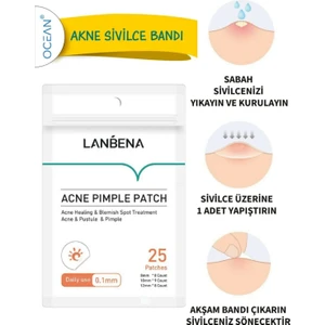 Lanbena Bandı Gündüz