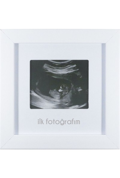 Fufizu Ilk Fotoğrafım Bebek Ultrason Çerçevesi - Bebek Odası Resim Anı Çerçevesi