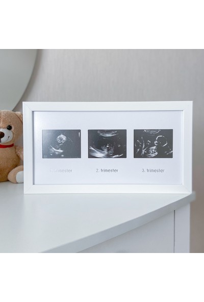 Fufizu Üçlü Ultrason Anı Çerçevesi - Gebelikte Bebeğin Gelişimini Üç Trimester Anı Olarak Saklayın