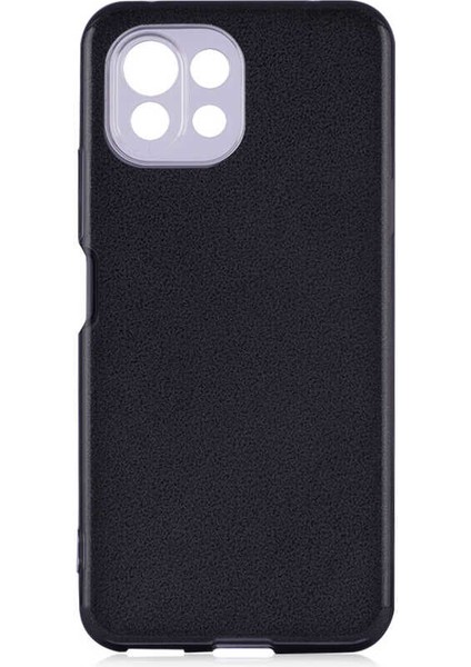 Xiaomi Mi 11 Lite Kılıf Simli Parlak Shining Kapak
