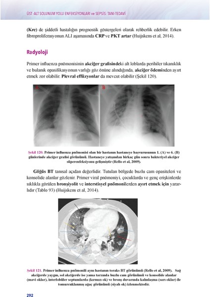 Ema Tıp Kitabevi Üst-Alt Solunum Yolu Enfeksiyonları ve Sepsis