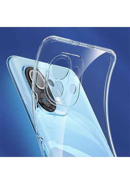 Gor Xiaomi Mi 11 Kılıf Kamera Korumalı Şeffaf Silikon Kılıf ALL-34461 indirimleri