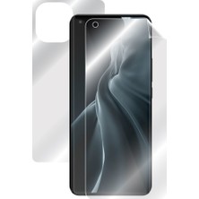 Ipg Xiaomi Mi 11 5g Tam Kaplama (Ekran ve Arka Koruma)