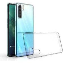 Nettech Oppo A91 Uyumlu Lüx Seri Silikon Kılıf