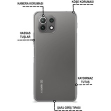 Case World Xiaomi Mi 11 Lite Silikon ile Uyumlu Kılıf Kamera Korumalı Tıpalı Şeffaf ile Uyumlu Kapak