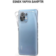 Case World Xiaomi Mi 11 Lite Silikon ile Uyumlu Kılıf Kamera Korumalı Tıpalı Şeffaf ile Uyumlu Kapak