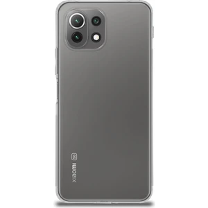 Case World Xiaomi Mi 11 Lite Silikon ile Uyumlu Kılıf Kamera Korumalı Tıpalı Şeffaf ile Uyumlu Kapak