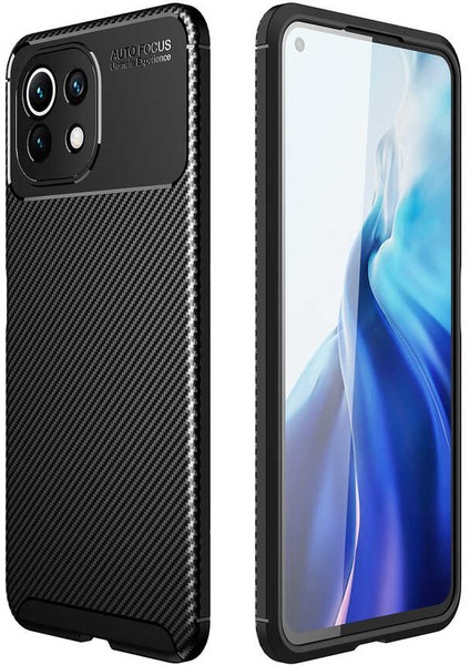 Xiaomi Mi 11 Lite Kılıf Antişok Karbon Desenli Negro Silikon Kapak
