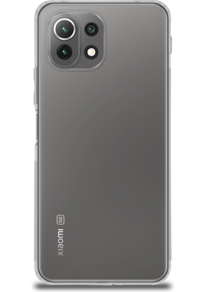 Case World Xiaomi Mi 11 Lite Silikon ile Uyumlu Kılıf Kamera Korumalı Tıpalı Şeffaf ile Uyumlu Kapak