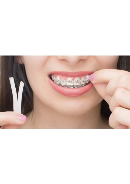 Ortodonti Mumu-Diş Teli Mumu-Orthodontic Wax fiyatları