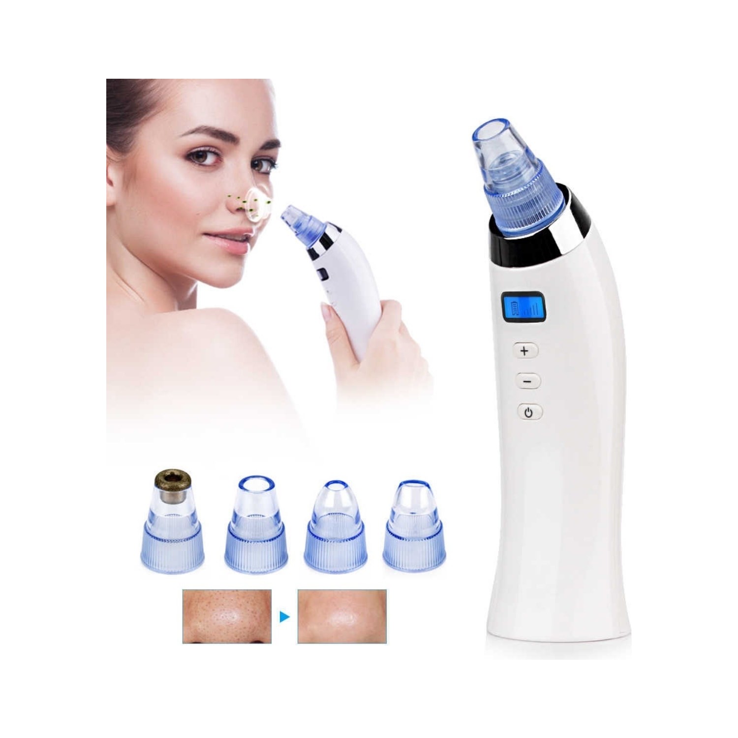 Toptan Bulurum Xn 8030 Beautiful Skin Care Expert Şarjlı Fiyatı