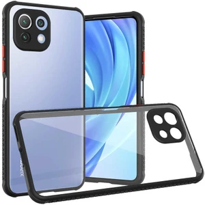 Mobaxaksesuar Xiaomi Mi 11 Lite Kılıf Kenar Renkli Sararmaz Şeffaf Kapak