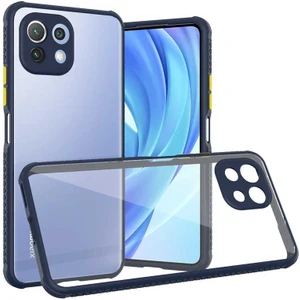 Mobaxaksesuar Xiaomi Mi 11 Lite Kılıf Kenar Renkli Sararmaz Şeffaf Kapak