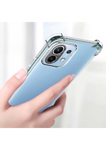 Xiaomi Mi 11 Lite Kılıf Kenar ve Kamera Korumalı Nitro Anti Shock Silikon fırsatları