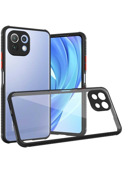 Xiaomi Mi 11 Lite Kılıf Kenar Renkli Sararmaz Şeffaf Kapak