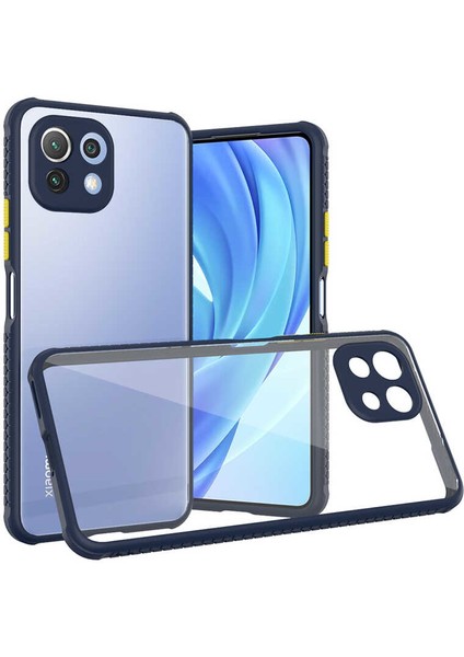 Xiaomi Mi 11 Lite Kılıf Kenar Renkli Sararmaz Şeffaf Kapak