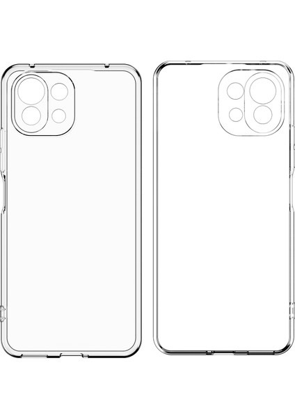 Xiaomi Mi 11 Lite Kılıf Renksiz Şeffaf Silikon Kamera Korumalı Kks fiyatları