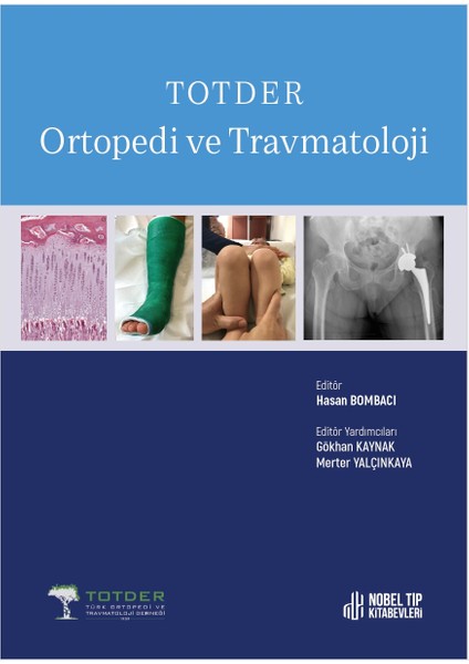 Totder Ortopedi ve Travmatoloji - Hasan Bombacı