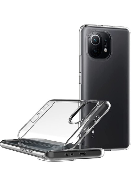 Xiaomi Mi 11 İçin Ultra İnce Şeffaf Açık Yumuşak Tpu Kılıf Kapaklı Açık (Yurt Dışından)