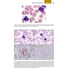 Williams Hematoloji El Kitabı - Mehmet Ali Özcan