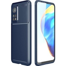 Dlrcase Xiaomi Redmi K30S Kılıf Negro Karbon Dizayn+Full Ekran Koruyucu Lacivert