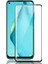 Oneplus Nord N10 5g Kılıf Niss Deri Görünümlü Silikon+Full Ekran Siyah 2