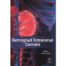 Retrograd Intrarenal Cerrahi