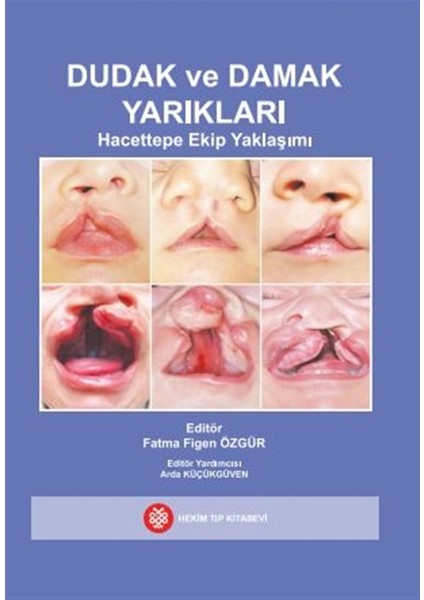 Dudak ve Damak Yarıkları - Fatma Figen Özgür