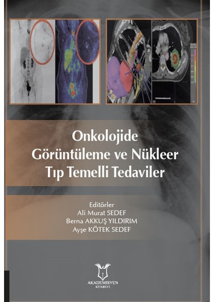 Onkolojide Görüntüleme ve Nükleer Tıp Temelli Tedaviler - Ali Murat Sedef