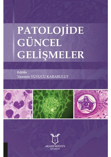 Patolojide Güncel Gelişmeler - Yasemin Yuyucu Karabulut