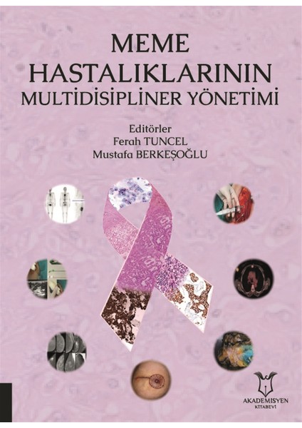 Meme Hastalıklarının Multidisipliner Yönetimi - Ferah Tuncel