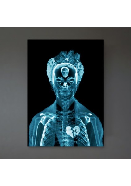 Frida X-Ray