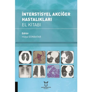 İnterstisyel Akciğer Hastalıkları El Kitabı - Hülya Günbatar