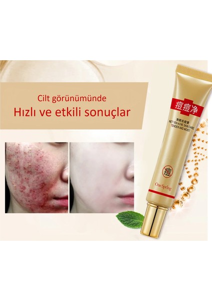 Eğilimli Ciltler Için Çay Ağacı Bakım Kremi 30 gr